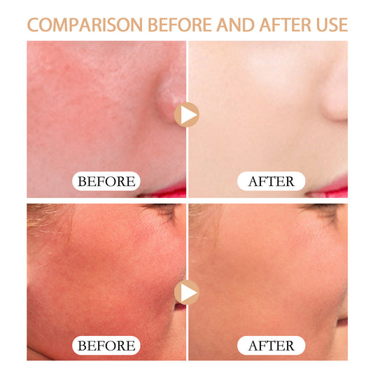 Erfrischende, nicht fettende, natürliche UV-Schutzcreme