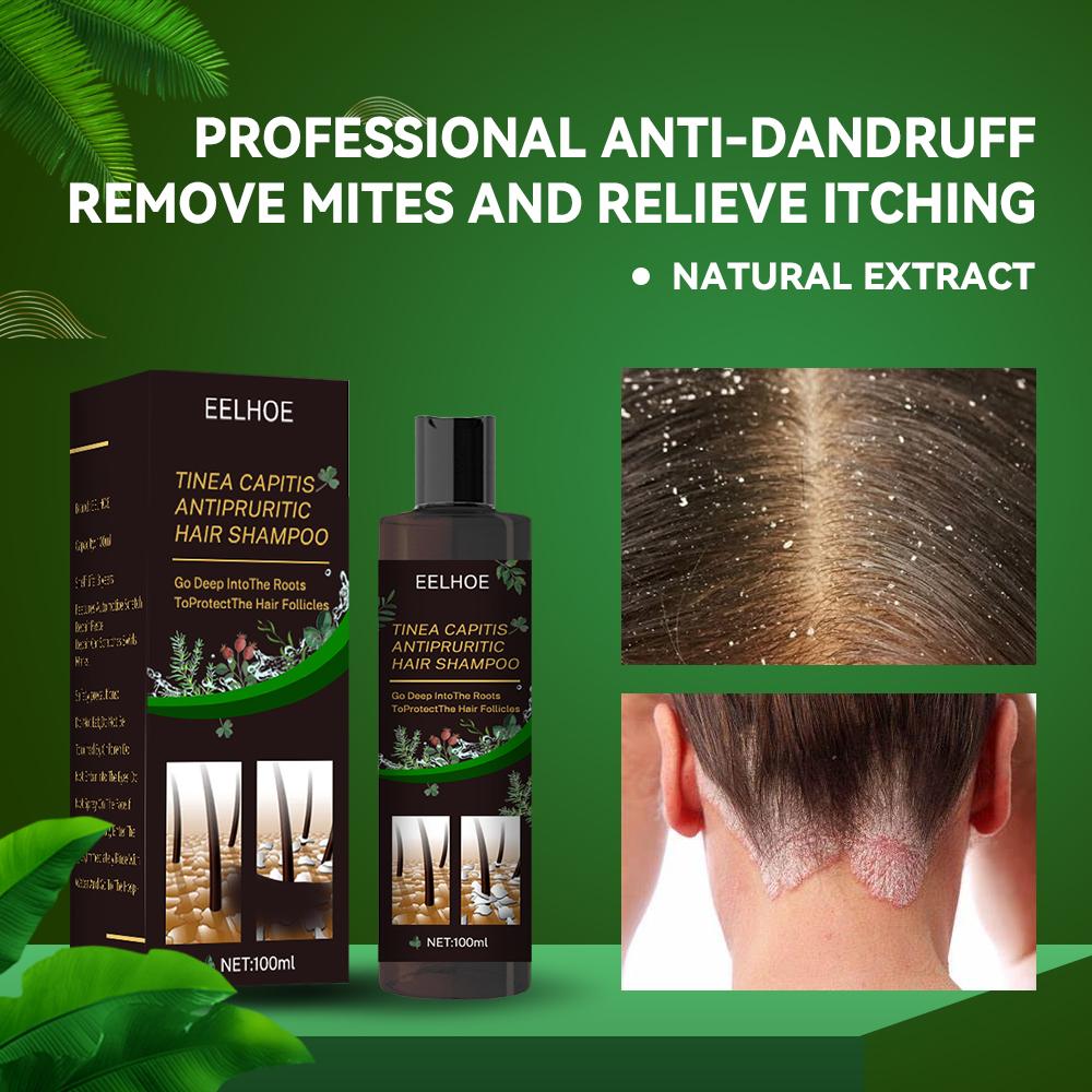 EELHOE Anti-Schuppen-Shampoo – Lindert Juckreiz, beugt Haarausfall vor, reguliert die Talgproduktion und erfrischt die Haut