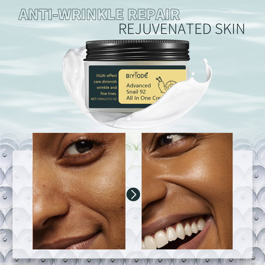 Anti-Aging-, straffende, liftende, feuchtigkeitsspendende und faltenreduzierende Gesichtscreme mit Schneckenextrakt 92 – die perfekte All-in-One-Gesichtscreme