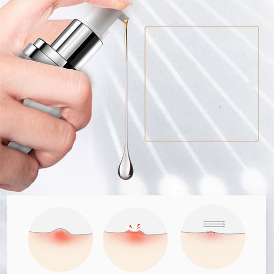 Aktives Peptidserum zur Aufhellung von Aknenarben