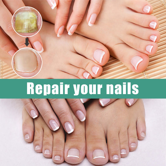 Nagelpilz-Reparaturlotion zum Selbermachen