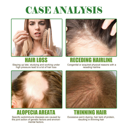 Rosmarin-Haarpflegeöl zur Reparatur von Haarschäden