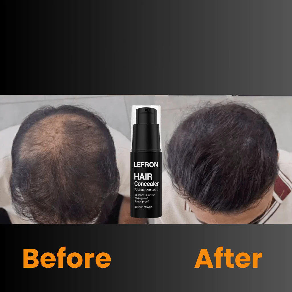 Lefron Magic Haarverdichtung