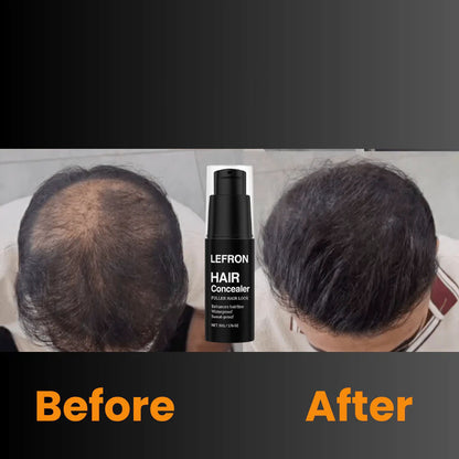 Lefron Magic Haarverdichtung