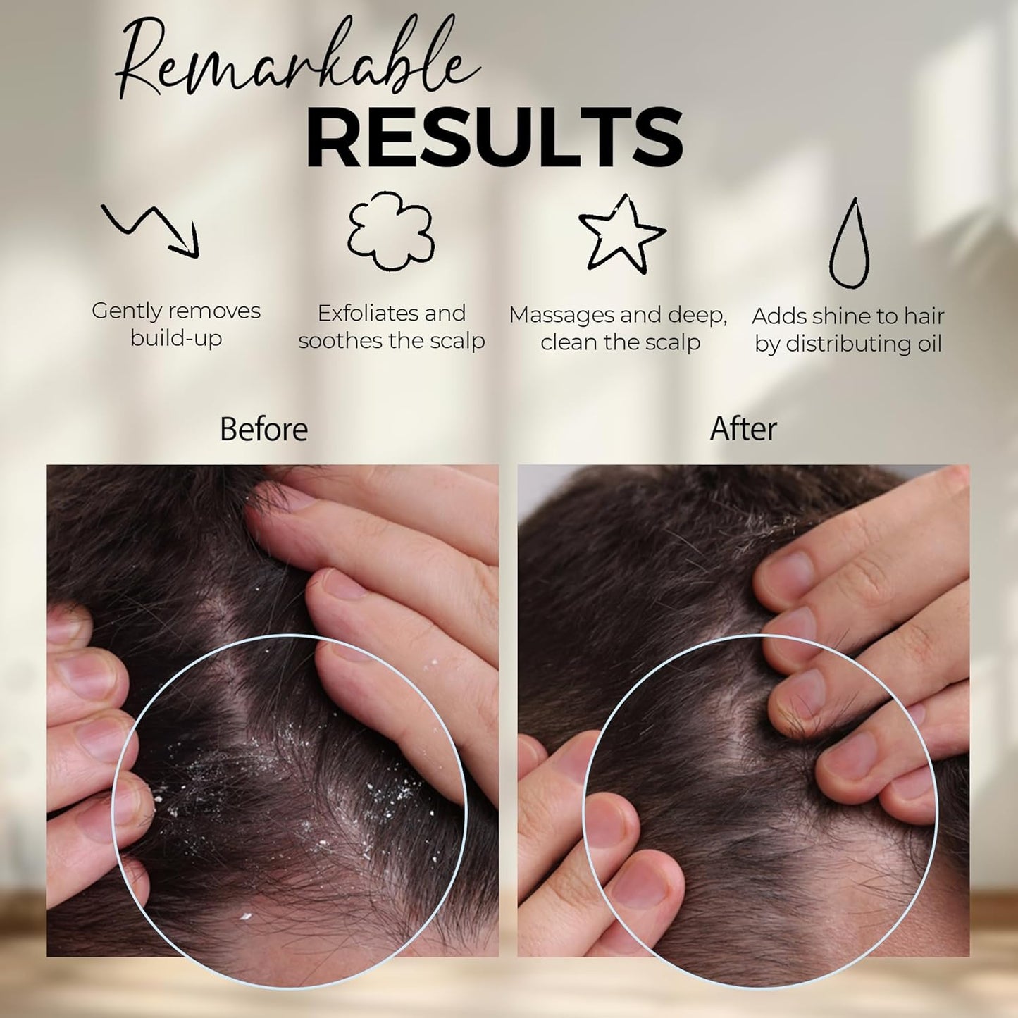 Kopfhautmassage-Shampoobürste – Silikon-Kopfhautpeeling zur Schuppenentfernung und Förderung des Haarwachstums, Kopfhautbürste für nasses und trockenes Haar, Shampoobürste für Männer und Frauen