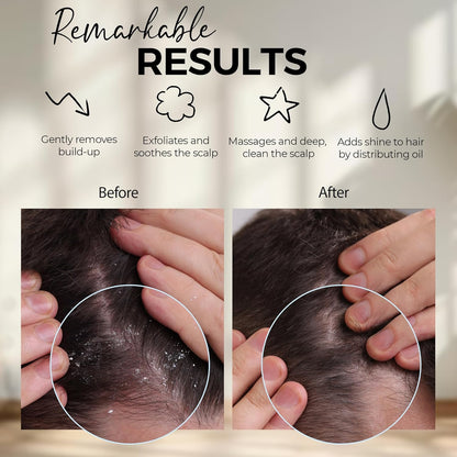 Kopfhautmassage-Shampoobürste – Silikon-Kopfhautpeeling zur Schuppenentfernung und Förderung des Haarwachstums, Kopfhautbürste für nasses und trockenes Haar, Shampoobürste für Männer und Frauen