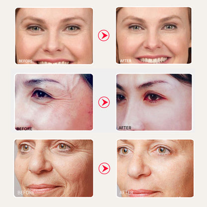 Feuchtigkeitscreme mit Schneckenextrakt