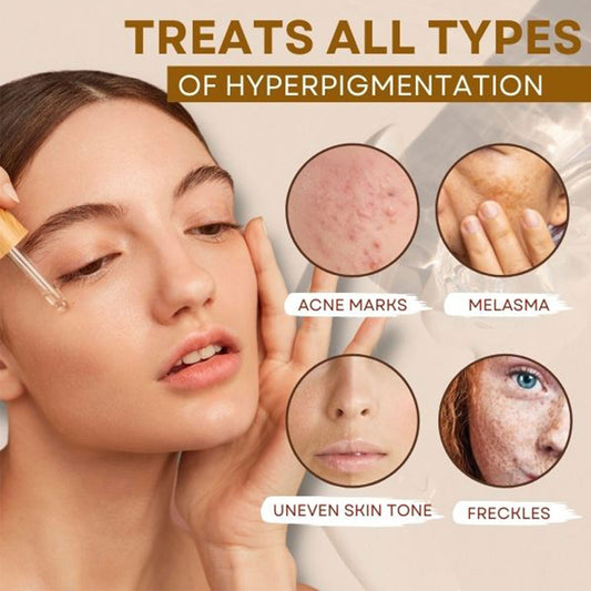 Spot Fading Melanin Skin Rejuvenation Brightening And Moisturizing Essence