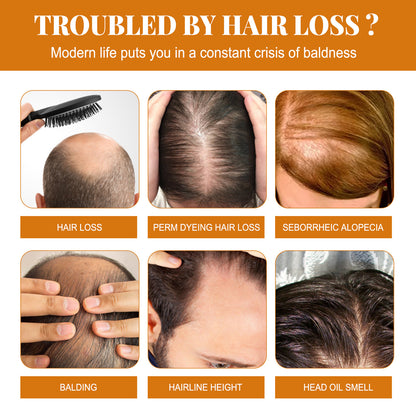 Pferdeöl-Shampoo – Tiefenreinigung der Kopfhaut, Schuppenkontrolle, Ölregulierung, für voluminöses, geschmeidiges Haar, Feuchtigkeitspflege