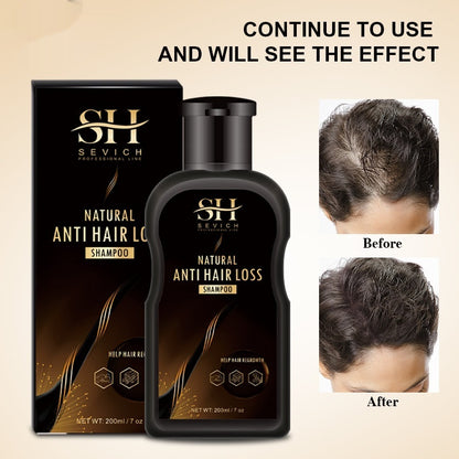 Ingwer-Shampoo gegen Haarausfall, Schuppen und dichtes Haar