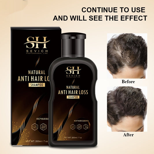 Ingwer-Shampoo gegen Haarausfall, Schuppen und dichtes Haar