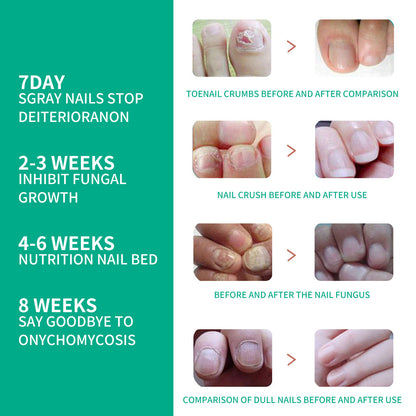 Nagelreparatur bei rohen, faulen Zehennägeln, sanfte Entfernung von grauen Nägeln