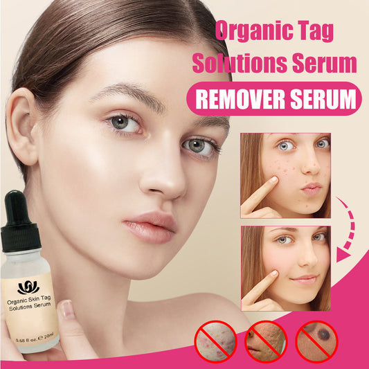 Organic Tags Solutions Serum No Trace Painle Hautanhängsel-Entferner-Serum Muttermal-Entfernungscreme Schmerzfreie Gesichtswarzen-Muttermal-Sommersprossen-Entfernung