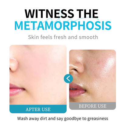 HUNMUI Aminosäure-Gesichtsreinigung 60 g 