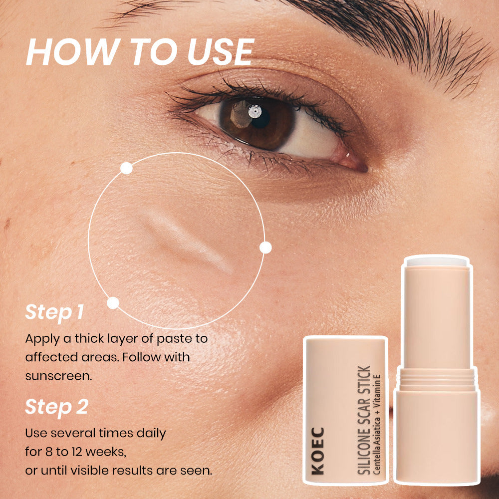 Silikon-Narbenstift Feuchtigkeitsspendend Beruhigend Sanft
