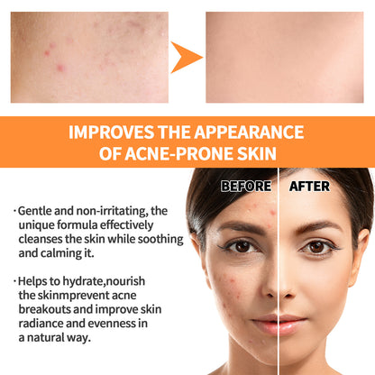 Ingwer-Gelbe Schlamm-Gesichtsmaske, feste Gesichtsmaske gegen Akne, verkleinert die Poren bei geschlossenem Mund