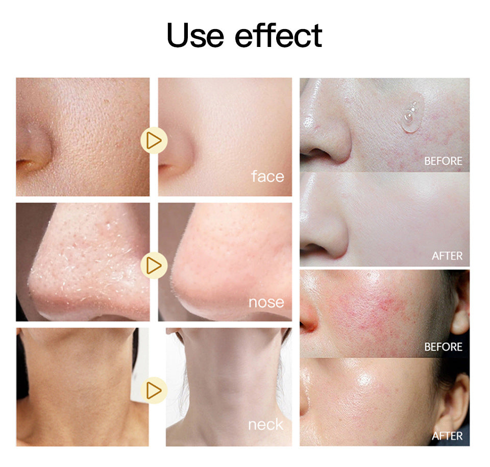 Feuchtigkeitsspendende Essenz mit Schneckenextrakt – nährend, feuchtigkeitsspendend und pflegend