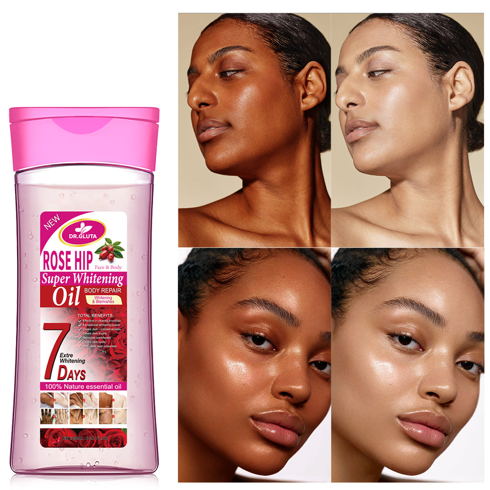 Hagebutten-Körperöl Super Whitening Natürliches ätherisches Öl Hautpflege Anti-Aging 200 ml 