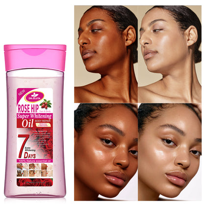 Hagebutten-Körperöl Super Whitening Natürliches ätherisches Öl Hautpflege Anti-Aging 200 ml 