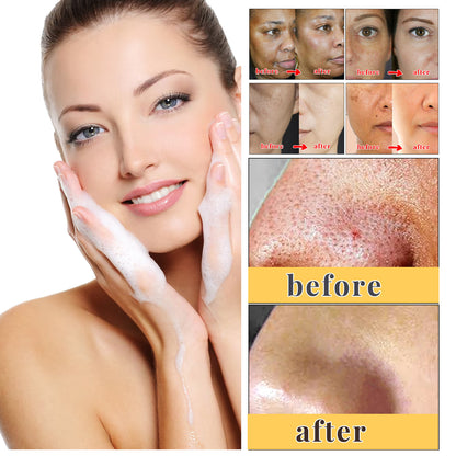 Gesichtswaschgel, Gesichtsseife, reinigend und feuchtigkeitsspendend