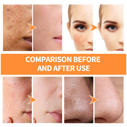 Ingwer-Gelbe Schlamm-Gesichtsmaske, feste Gesichtsmaske gegen Akne, verkleinert die Poren bei geschlossenem Mund