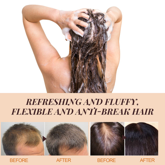 Pferdeöl-Shampoo – Tiefenreinigung der Kopfhaut, Schuppenkontrolle, Ölregulierung, für voluminöses, geschmeidiges Haar, Feuchtigkeitspflege