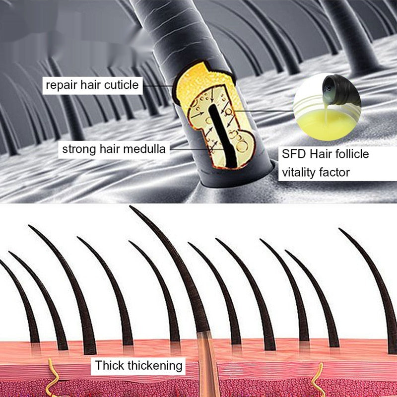 Ingwer-Shampoo gegen Haarausfall, Schuppen und dichtes Haar