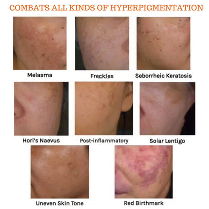 Aufhellende und feuchtigkeitsspendende Essenz zur Reduzierung von Pigmentflecken und zur Hautverjüngung